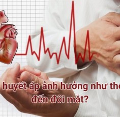Tăng huyết áp ảnh hưởng gì đến đôi mắt? Cách phòng ngừa